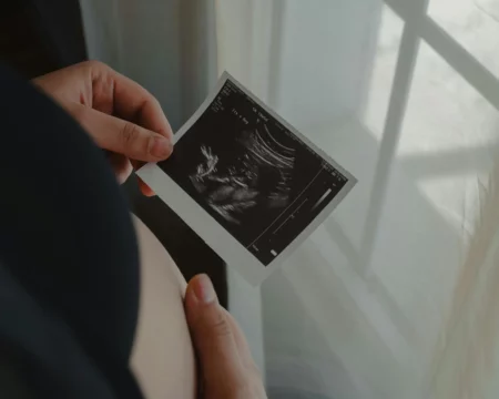 Ultrasound Scan Photo