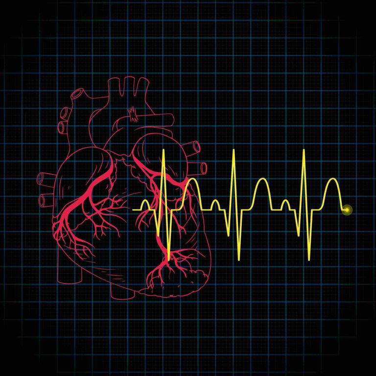 Cardiac Arrest vs Heart Attack: What You Need to Know Stylized human heart with ECG trace showing cardiac electrical activity